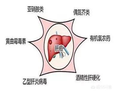 肝癌什么症状,肝癌的五大早期症状是什么？