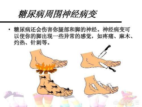 糖尿病人的手,脚肌肉酸痛,是为什么?-百科网