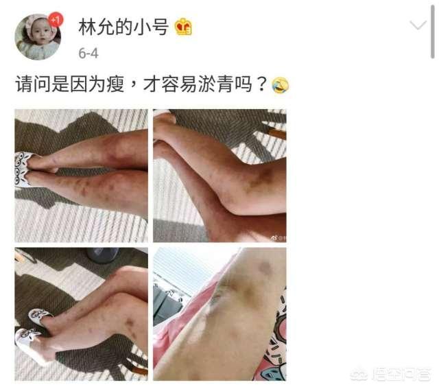 刘德华坠马:刘德华坠马后复出是真的嘛？