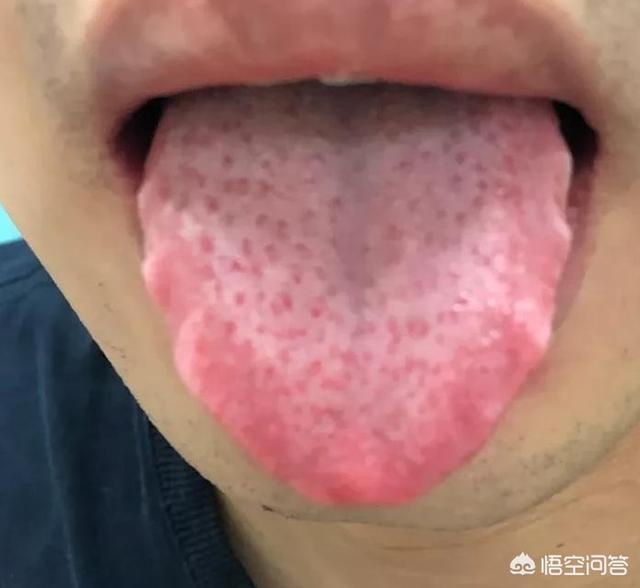 杨臭脚:女的，35岁没男朋友，找一婚男的难度大吗