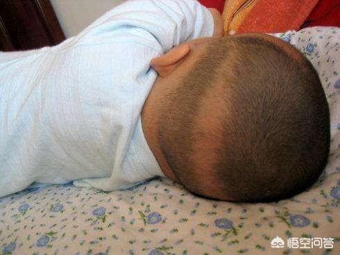 枕秃是什么意思，宝宝有枕秃是缺少了什么？