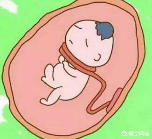 头条问答 - 39周了发现脐带绕颈两周,这时候应该多运动还是少运动?