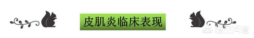 皮肤肿瘤疾病的元凶:皮肤过敏和肿瘤有什么关系？