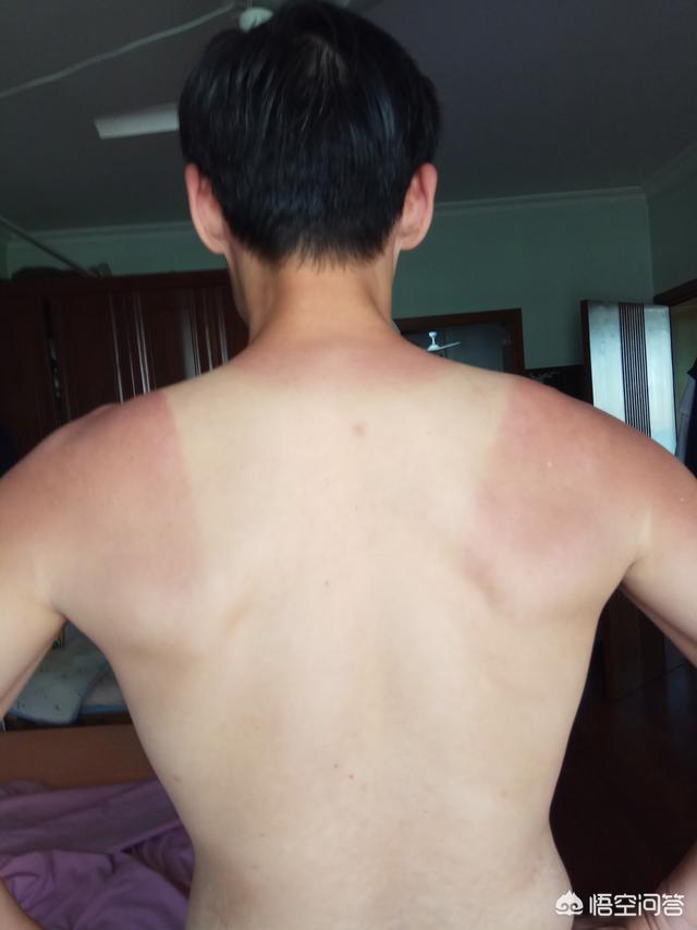瘦人增肌出现生长纹:很瘦的人进行增肌锻炼的同时适合跑步吗？