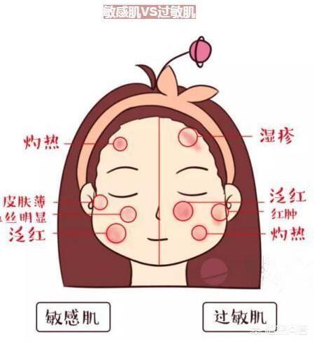 敏感肌用哪些牌子的护肤品？