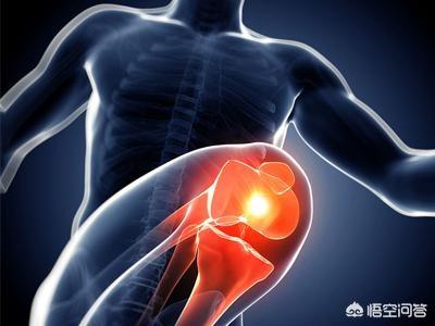 导致膝关节炎原因有哪些，膝关节炎的症状表现有哪些，补充多点氨糖软骨素能缓解吗