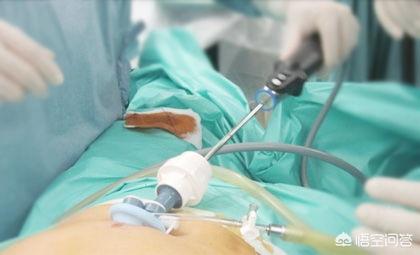 腹腔镜手术后注意事项:腹腔镜手术后注意事项及护理 宫腹腔镜微创手术后怎么调理能早点怀孕？