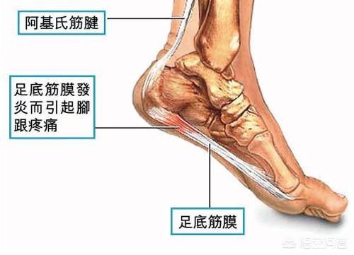 脚后跟疼是什么原因,足后跟痛什么原因引起的？