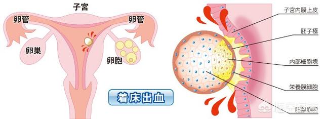 头条问答 怀孕初期有褐色液体流出是什么原因 美妈很帅的回答 0赞