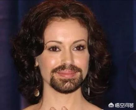 女生长小胡子:女生嘴边长小胡子应该怎么办