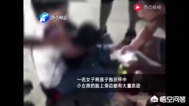 被狗咬伤险些毁容:如何看待航空公司纵容爱狗人士带狗上飞机，结果咬伤了美国市长？ 被邻居的狗咬伤毁容