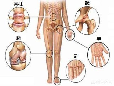 运动时听见关节响是怎么回事？
