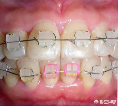 喻丝圆:筷子为什么一头方一头圆？
