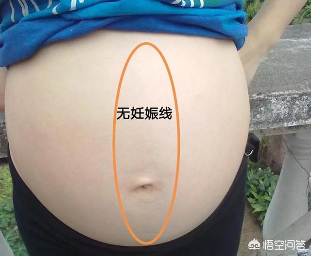 为什么少女会有腹中线，6个月的孕妇，为什么没有出现妊娠线呢