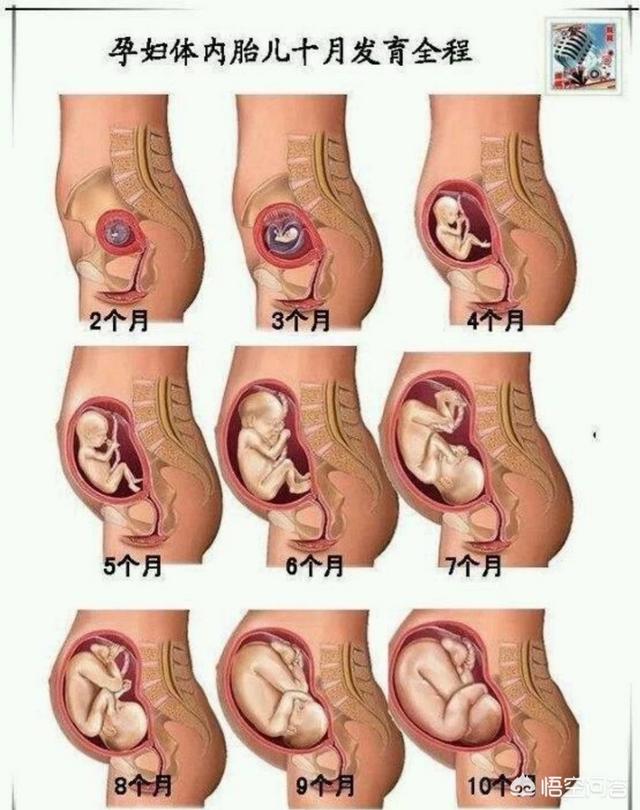 头条问答 怀孕四个月胎儿在哪个位置 22个回答