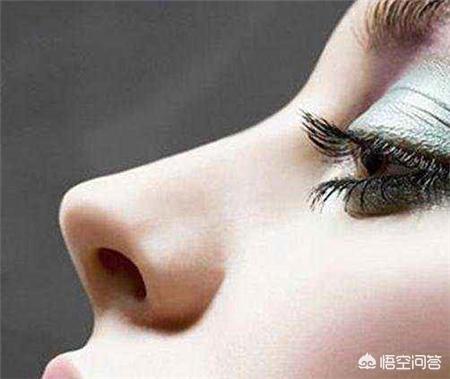 鼻综合手术拆线多少钱:鼻综合手术几天拆线 做完鼻整形修复手术后要怎么护理？