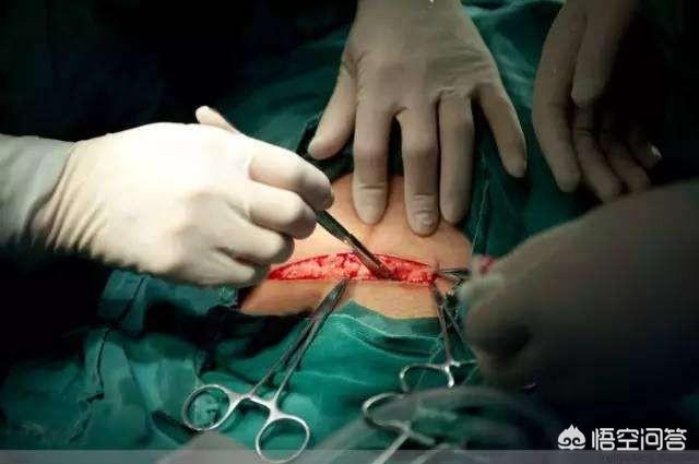 如何护理和恢复_清洁门户