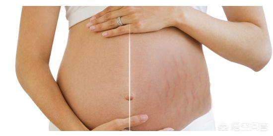 怀孕多久会长妊娠纹，怀孕7个多月没长妊娠纹，生了之后会长吗
