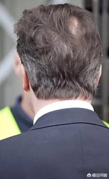 白头发长哪里最危险？