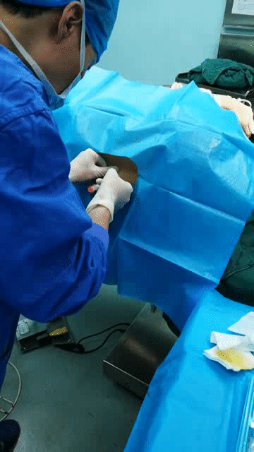 清创手术需要麻醉吗:脚部清创手术需要麻醉吗? 麻醉很痛吗？只是睡一觉吗？