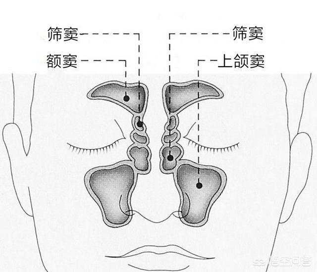 辅舒良效果怎么样(慢性鼻炎用辅舒良效果怎么样)