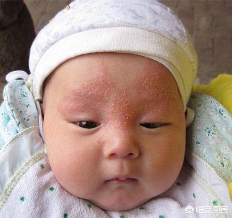 新生儿得了湿疹，该怎么办？