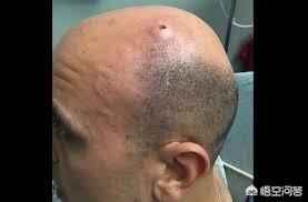 射水鱼狙击公式:射程40公里的大炮该怎么瞄准？