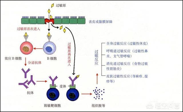 怎样预防过敏性鼻炎:如何预防过敏性疾病的发生？