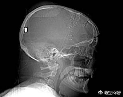 射水鱼狙击公式:射程40公里的大炮该怎么瞄准？
