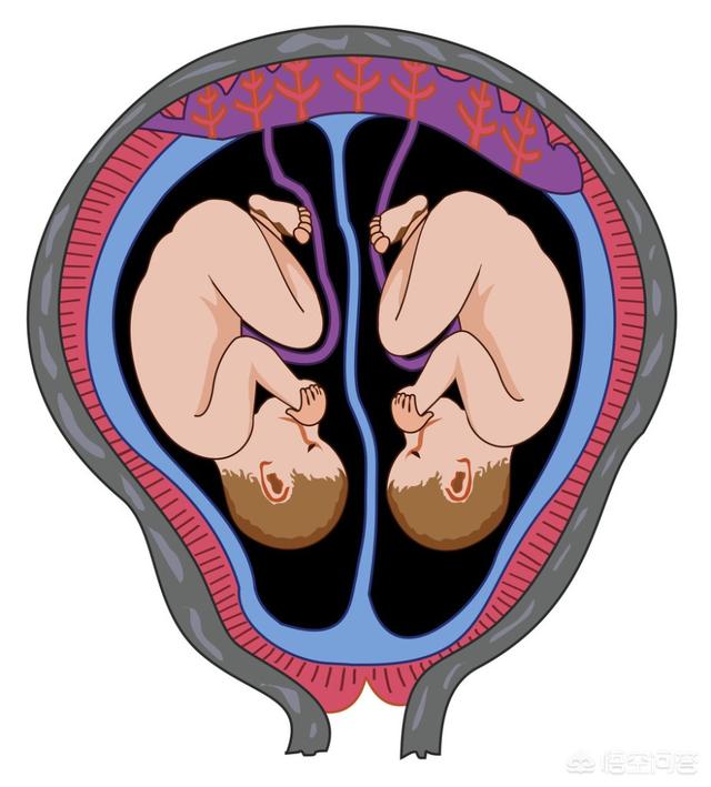 双头女婴:双胞胎是不是都会提前出生是否可以顺产