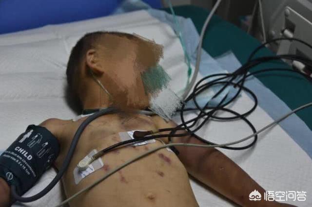 重庆小男孩:重庆垫江5岁男孩被亲奶奶毒打致昏迷，你怎么看