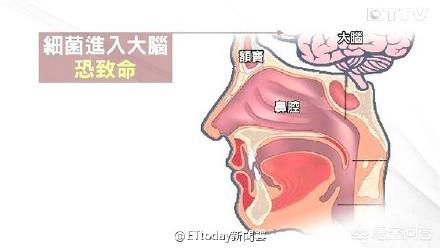 鼻梁怎么增高(鼻梁增高的方法有哪些)