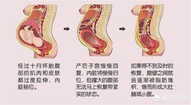 产后恶露是什么:产后恶露是什么样正常 产后怎么做能尽快排干净恶露，促进子宫尽快恢复？