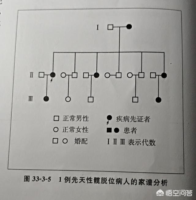 髋关节脱位:先天性髋关节脱位的原因是什么？