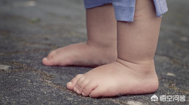 小孩儿风湿性关节炎的症状:孩子得了类风湿关节炎怎么办？