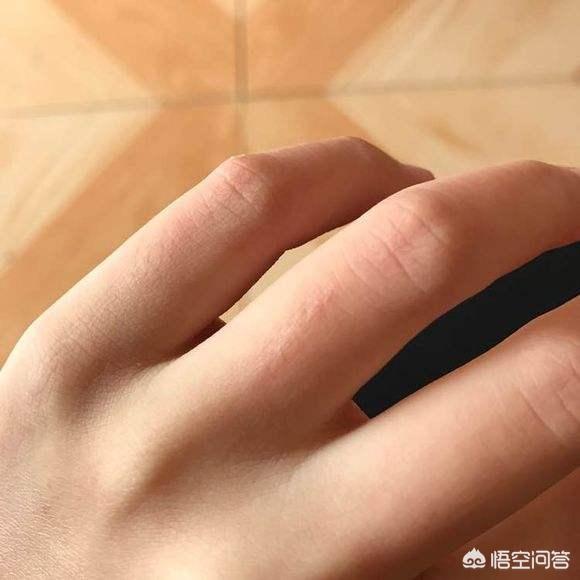 手指不小心被猫抓破了怎么办:宝宝让猫咪抓破了怎么办？