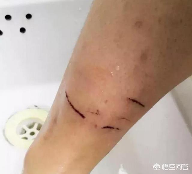 山东威海虐狗事件:如果小区里发生了恶狗咬人的事件，保安有权利对狗进行处置吗？