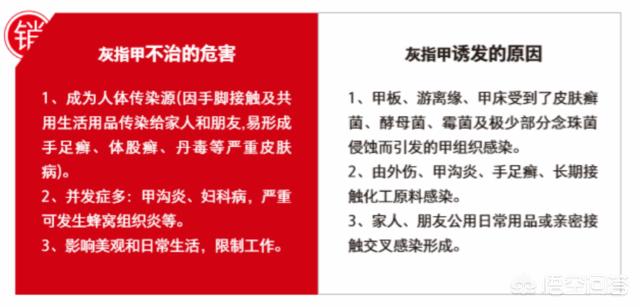 抗真菌药物 怎么吃:抗真菌药物怎么吃 灰指甲是吃药好还是擦药好啊？