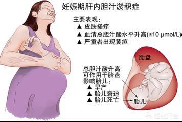 孕妈皮肤发痒是怎么回事，孕期身体发痒，应该怎么办