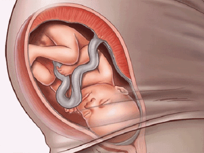 9个月的胎儿是以什么样的姿势呆在肚子里的？怀孕9个月要注意什么？