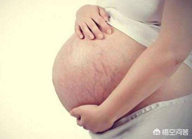怀孕多久会长妊娠纹？为什么会长妊娠纹？插图40