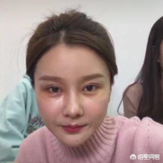开眼角对比图:割双眼皮不开眼角是一种什么体验？