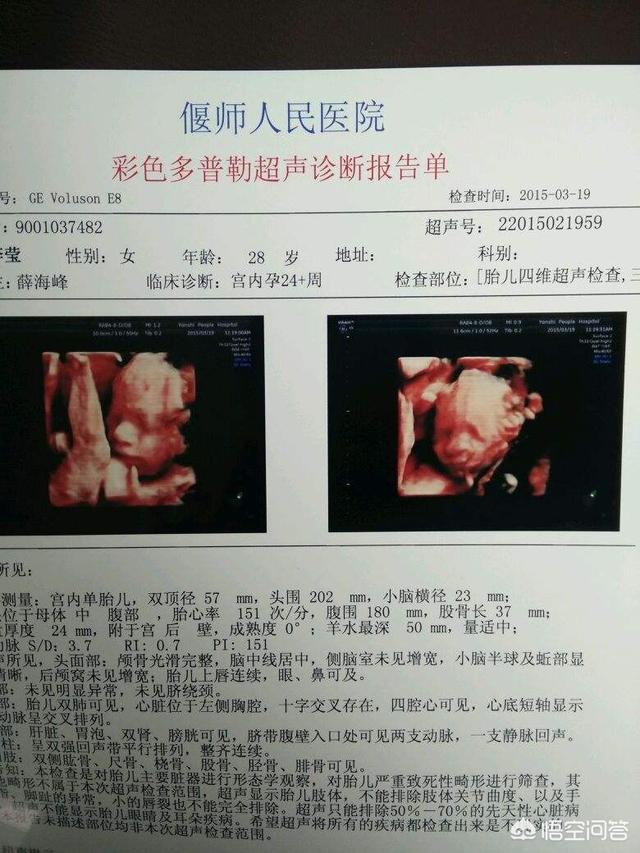 四维b超单，可以看出宝宝是男是女吗