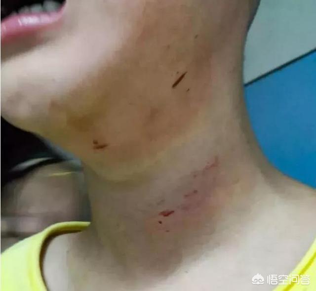 山东威海虐狗事件:如果小区里发生了恶狗咬人的事件，保安有权利对狗进行处置吗？