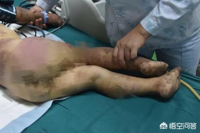 重庆小男孩:重庆垫江5岁男孩被亲奶奶毒打致昏迷，你怎么看