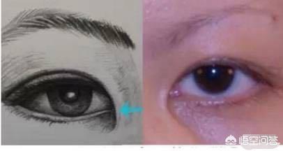 开眼角对比图:割双眼皮不开眼角是一种什么体验？