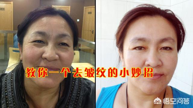 色斑和皱纹该怎么淡化或祛除？