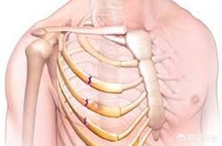 肋骨骨折怎么处理，肋骨骨折怎么胸外心脏按压