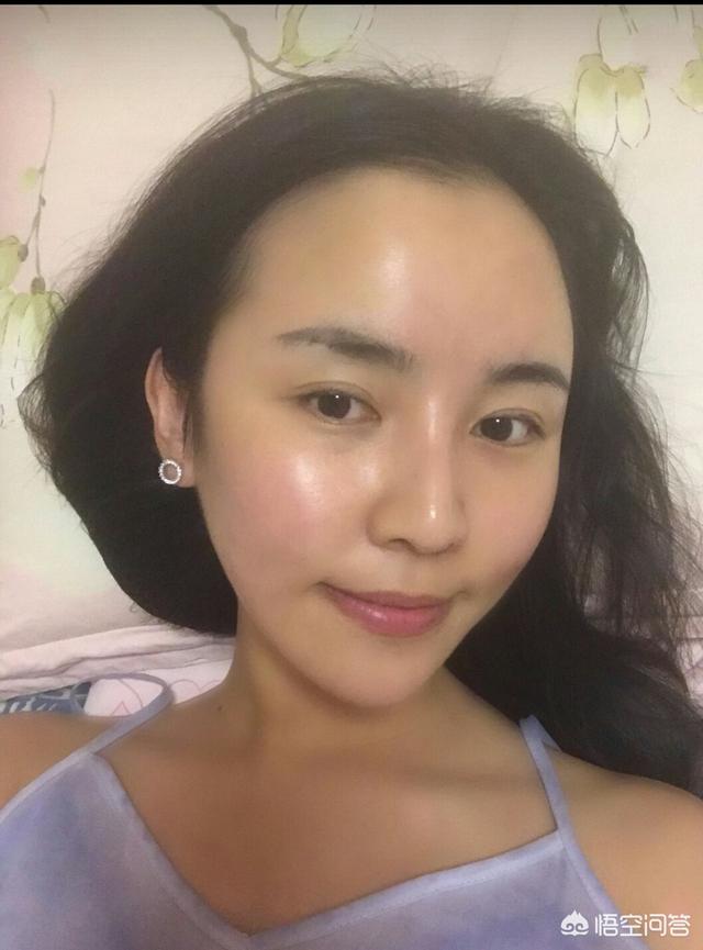 祛痘秘方(祛痘配方)