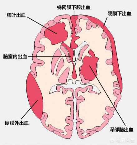 枕动脉痛图片